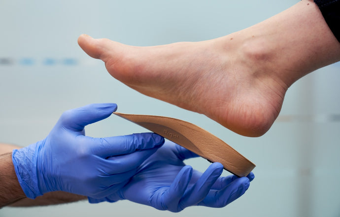 Insoles and Orthotics: Q&A with Head of Podiatry