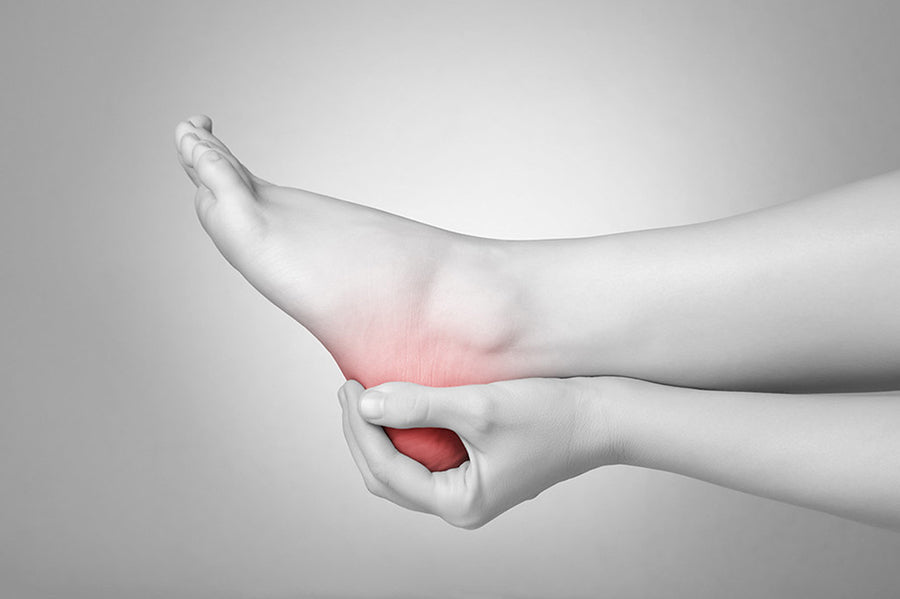 Plantar Fasciitis: Everything You Need To Know