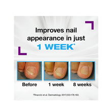 Load image into Gallery viewer, Emtrix Fungal Nail Treatment Cream
